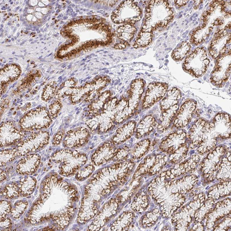 Anti-ZNF526 Antibody