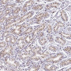 Anti-ZNF526 Antibody