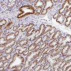 Anti-ZNF526 Antibody