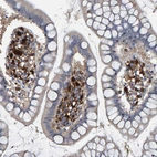 Immunohistochemical staining of human small intestine shows moderate to strong positivity in lymphoid cells.