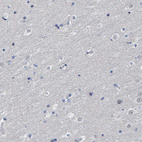 Immunohistochemical staining of human cerebral cortex shows no cytoplasmic positivity in neuronal cells as expected.
