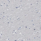 Immunohistochemical staining of human cerebral cortex shows no cytoplasmic positivity in neuronal cells as expected.