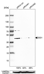 Western blot analysis in EFO-21 cells transfected with control siRNA, target specific siRNA probe #1 and #2, using Anti-IDO1 antibody. Remaining relative intensity is presented. Loading control: Anti-PPIB.