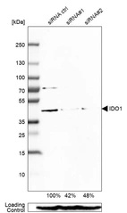 Western blot analysis in EFO-21 cells transfected with control siRNA, target specific siRNA probe #1 and #2, using Anti-IDO1 antibody. Remaining relative intensity is presented. Loading control: Anti-PPIB.