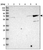Lane 1: Marker [kDa] 230, 130, 95, 72, 56, 36, 28, 17, 11_br/_Lane 2: Human cell line RT-4_br/_Lane 3: Human cell line U-251MG sp_br/_Lane 4: Human plasma (IgG/HSA depleted)_br/_Lane 5: Human liver tissue_br/_Lane 6: Human tonsil tissue