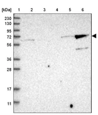 Lane 1: Marker [kDa] 230, 130, 95, 72, 56, 36, 28, 17, 11_br/_Lane 2: Human cell line RT-4_br/_Lane 3: Human cell line U-251MG sp_br/_Lane 4: Human plasma (IgG/HSA depleted)_br/_Lane 5: Human liver tissue_br/_Lane 6: Human tonsil tissue