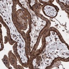 Anti-PIK3R6 Antibody