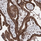 Anti-PIK3R6 Antibody