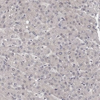 Immunohistochemical staining of human liver shows low expression as expected.