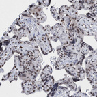 Immunohistochemical staining of human placenta shows moderate nuclear positivity in trophoblastic cells.