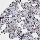 Immunohistochemical staining of human placenta shows moderate nuclear positivity in trophoblastic cells.