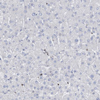 Immunohistochemical staining of human liver shows no positivity in hepatocytes as expected.