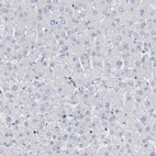 Immunohistochemical staining of human liver shows no positivity in hepatocytes as expected.