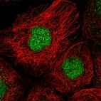 Immunofluorescent staining of human cell line A-431 shows localization to nucleoplasm.