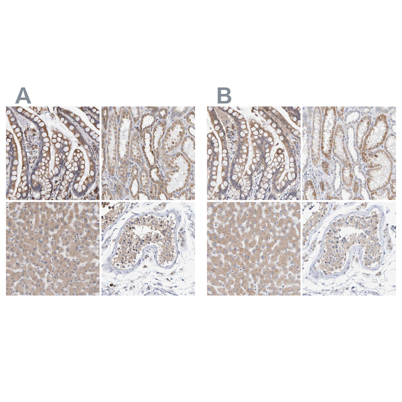 Anti-SGPL1 Antibody