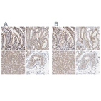 Anti-SGPL1 Antibody