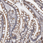 Immunohistochemical staining of human colon shows moderate cytoplasmic positivity in glandular cells.