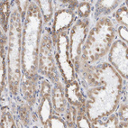 Immunohistochemical staining of human kidney shows moderate granular 
 cytoplasmic positivity in cells in tubules.