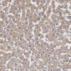 Immunohistochemical staining of human liver shows weak to moderate granular 
 cytoplasmic positivity in hepatocytes.