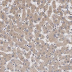 Immunohistochemical staining of human liver shows weak to moderate granular 
 cytoplasmic positivity in hepatocytes.