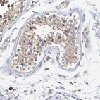 Immunohistochemical staining of human testis shows weak to moderate granular cytoplasmic positivity in cells in seminiferous ducts.