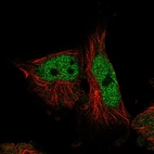 Immunofluorescent staining of human cell line U-251 MG shows localization to nucleoplasm.