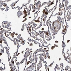 Anti-SLIT2 Antibody