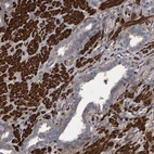 Immunohistochemical staining of human prostate shows strong cytoplasmic positivity in smooth muscle cells.