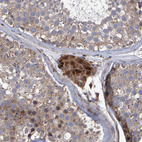 Immunohistochemical staining of human testis shows strong cytoplasmic positivity in Leydig cells.