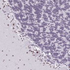 Anti-ZNF800 Antibody