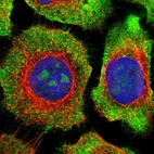 Immunofluorescent staining of human cell line A-431 shows localization to nucleoli & cytosol.