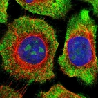 Immunofluorescent staining of human cell line A-431 shows localization to nucleoli & cytosol.