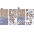 Immunohistochemical staining of human cerebral cortex, kidney, lymph node and testis using Anti-EFR3A antibody HPA023092 (A) shows similar protein distribution across tissues to independent antibody HPA022859 (B).