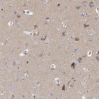 Immunohistochemical staining of human cerebral cortex shows high expression.