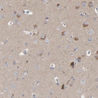 Immunohistochemical staining of human cerebral cortex shows high expression.