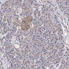 Immunohistochemical staining of human pancreas shows low expression as expected.