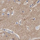 Immunohistochemical staining of human cerebral cortex using Anti-EFR3A antibody HPA023092.