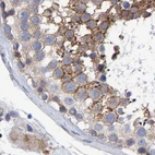 Immunohistochemical staining of human testis using Anti-EFR3A antibody HPA023092.