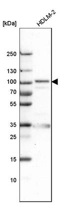 Western blot analysis in human cell line HDLM-2.