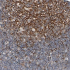 Immunohistochemical staining of human lymphoid tissues shows strong cytoplasmic positivity in germinal center cells.