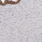 Immunohistochemical staining of human prostate shows no positivity in smooth muscle cells as expected.