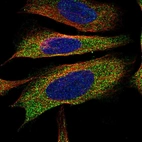 Immunofluorescent staining of human cell line U-2 OS shows localization to cytosol.