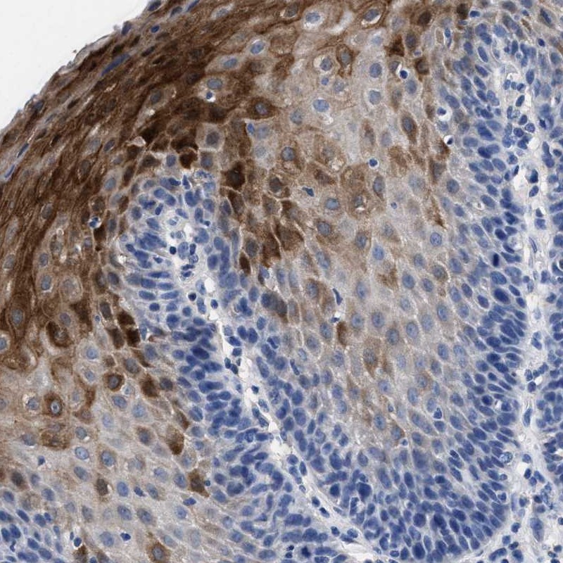 Anti-HID1 Antibody