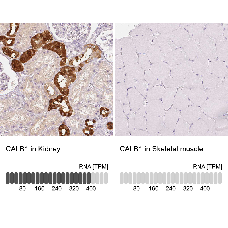 Anti-CALB1 Antibody
