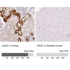 Anti-CALB1 Antibody