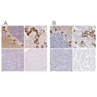 Immunohistochemical staining of human cerebellum, kidney, pancreas and skeletal muscle using Anti-CALB1 antibody HPA023099 (A) shows similar protein distribution across tissues to independent antibody HPA056734 (B).