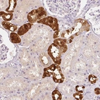Immunohistochemical staining of human kidney shows strong nuclear and cytoplasmic positivity in cells in tubules.