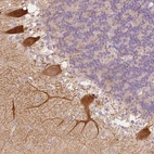 Immunohistochemical staining of human cerebellum shows strong cytoplasmic positivity in Purkinje cells.