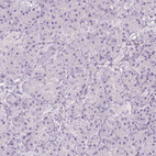 Immunohistochemical staining of human pancreas shows no positivity in exocrine glandular cells as expected.