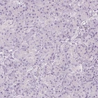 Immunohistochemical staining of human pancreas shows no positivity in exocrine glandular cells as expected.